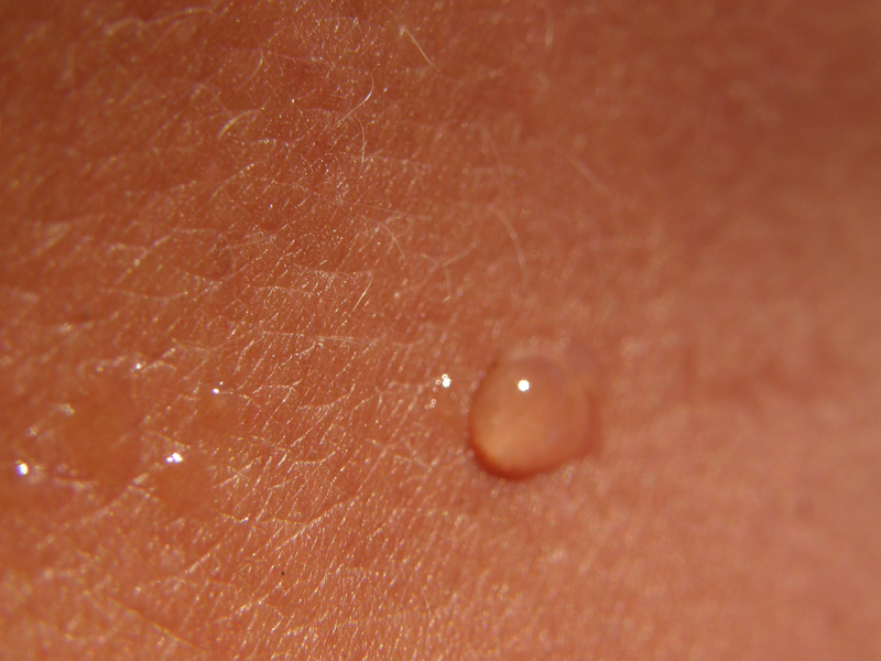 Illustration for article titled The Camera Inside This Satellite May Soon Scan Your Skin for Cancer